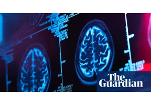 Second Canadian scientist alleges brain illness investigation was shut down