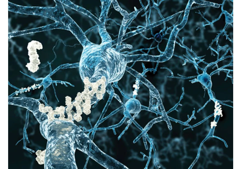 Alzheimer's Study Shows Ketone Bodies Help Clear Misfolded Proteins