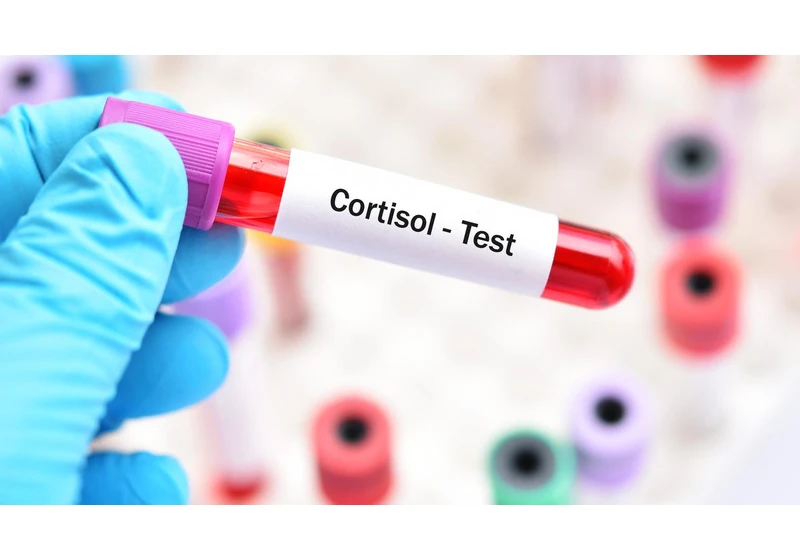 I Got a Blood Stress Test to Learn More About Cortisol and Its Effects on Our Bodies