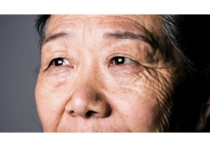 6 Common Eye Conditions to Watch for as You Age