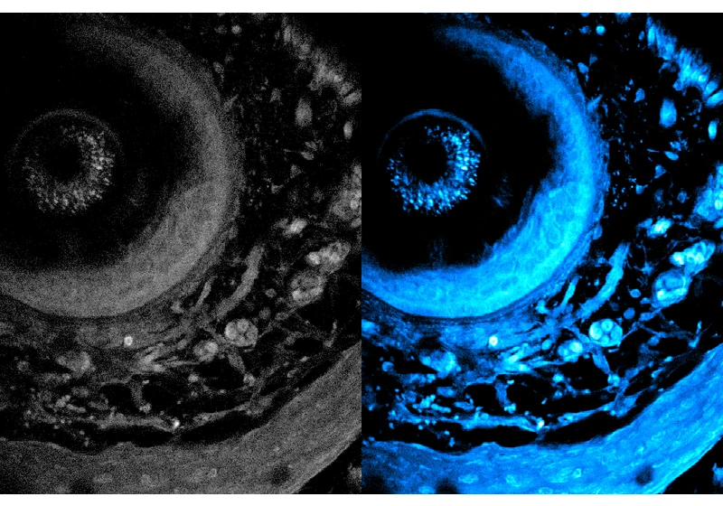 Noninvasive imaging method can penetrate deeper into living tissue