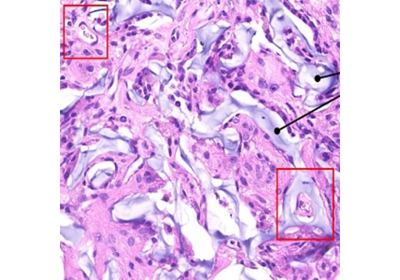 Hydrogel jako lešení pro růst nových neuronů v poškozeném mozku