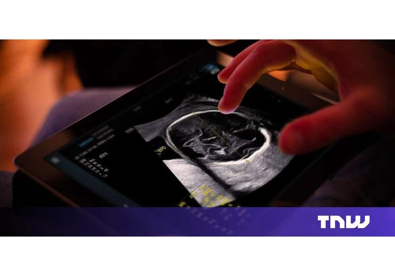 Samsung completes €86M takeover of French AI ultrasound startup Sonio