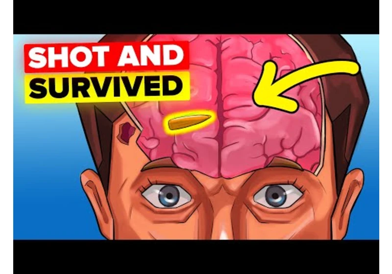 Survive Getting Shot in the Head (Minute by Minute)