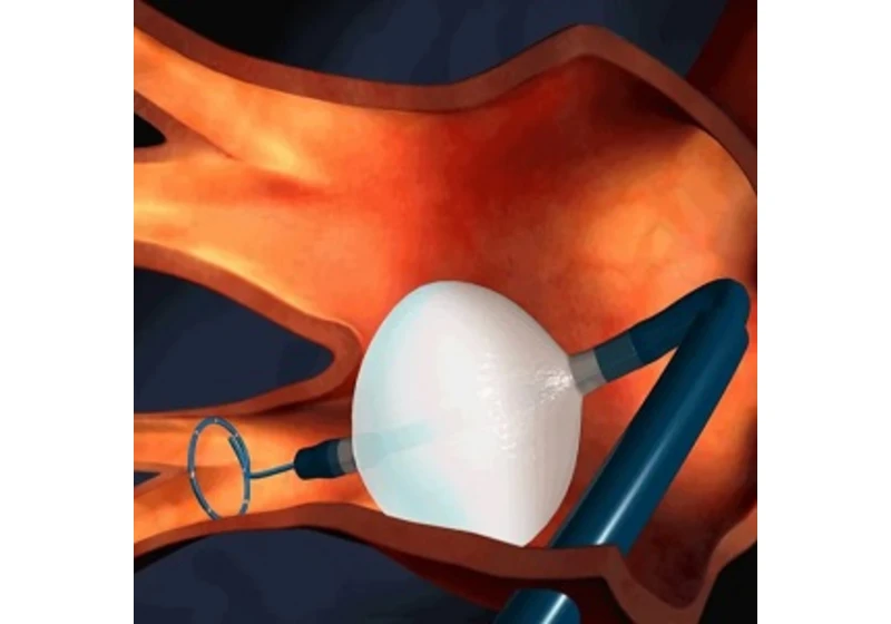 Kardiologické TOP STORIES 2022 podľa NEJM Journal Watch Cardiology