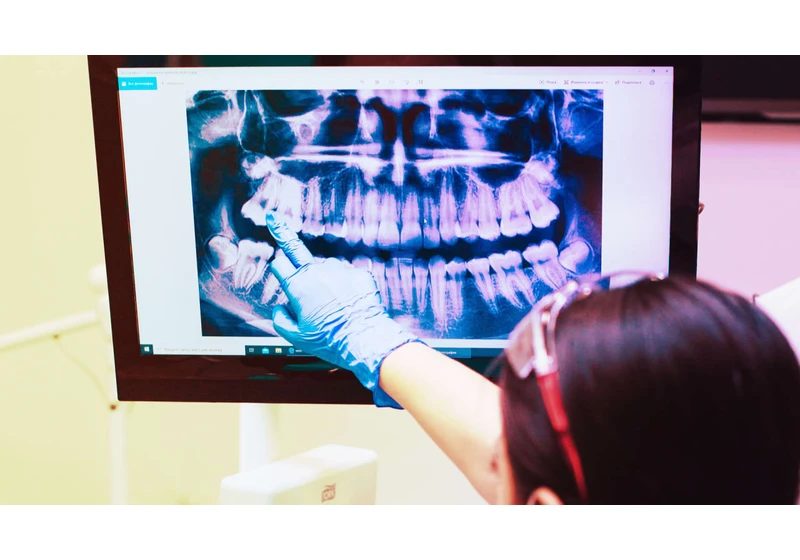 AI is primed to have an outsize impact on the field of dentistry