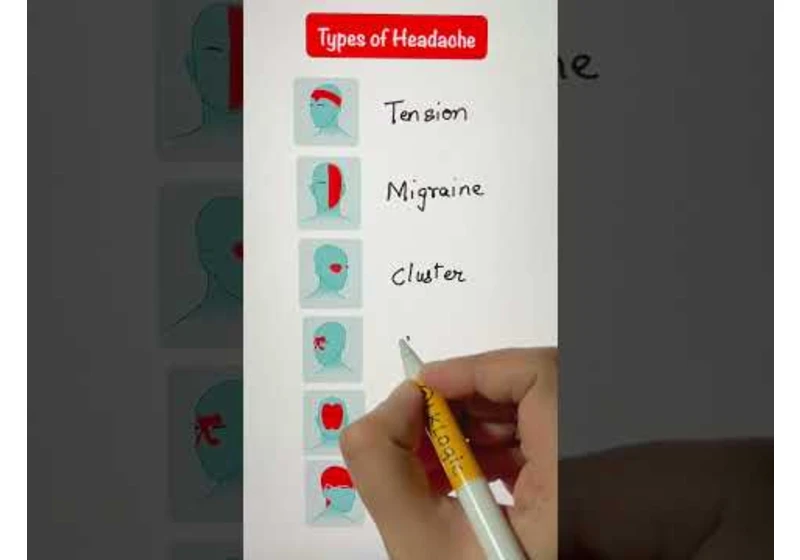 Types of Headaches - Sinus, Tension, cluster, Migraine, Spinal