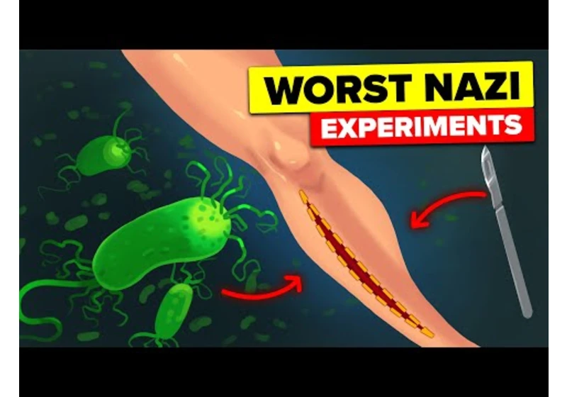 Bacteria Inside Wounds - Nazi Camp Experiments