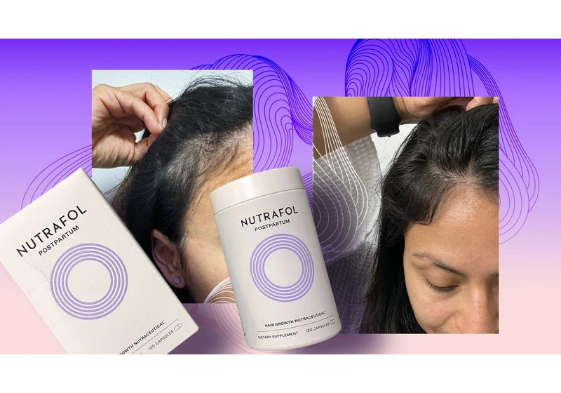 This Is the Secret Weapon That Helped Me Stop Losing My Hair After Having a Baby