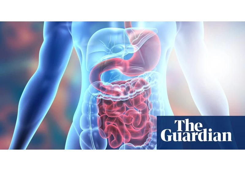 Researchers identify major driver of inflammatory bowel and related diseases