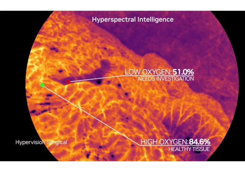 London-based Hypervision Surgical raises €7.5 million to redefine surgical imaging with AI and clinical edge computing